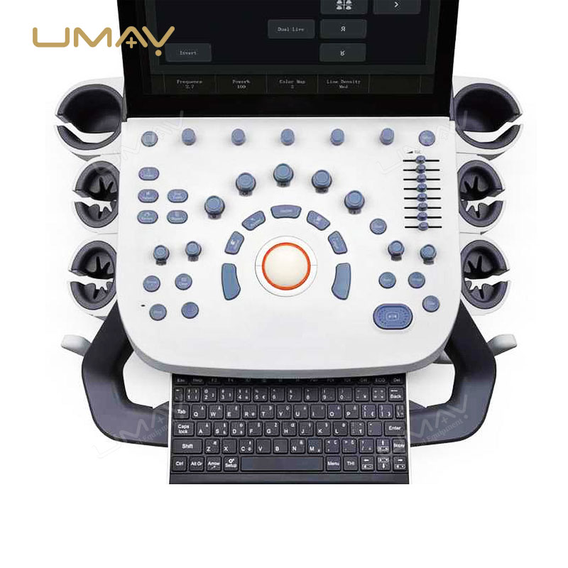 Budget-Wise Option P9 Color Doppler Ultrasound Machine for Clinic