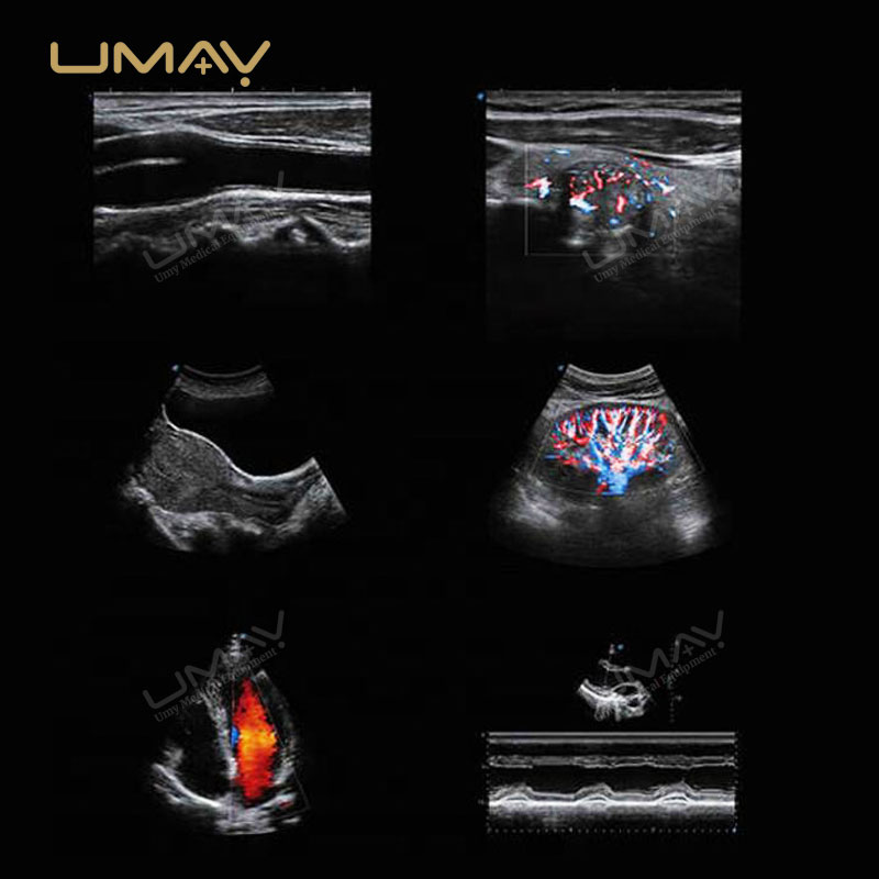 Budget-Wise Option P9 Color Doppler Ultrasound Machine for Clinic