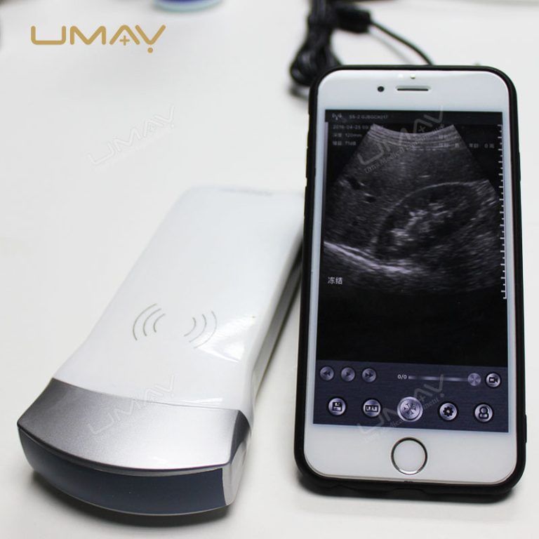 Wireless Linear and Convex Ultrasound Probes with Transducer Preferred by Experts-4